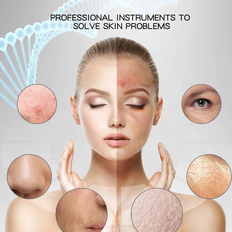 Tendance 2025 vente en gros visage ultrasons épurateur de peau Machine visage peau spatule points noirs dissolvant visage ascenseur peau épurateur