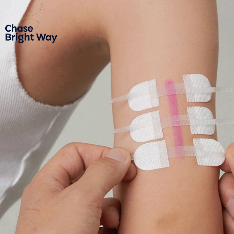 3Pcs/set Zipper Tie Wound Closure Patch Hemostatic Patch Wound Fast Suture Zipper Band-Aid Outdoor Portable