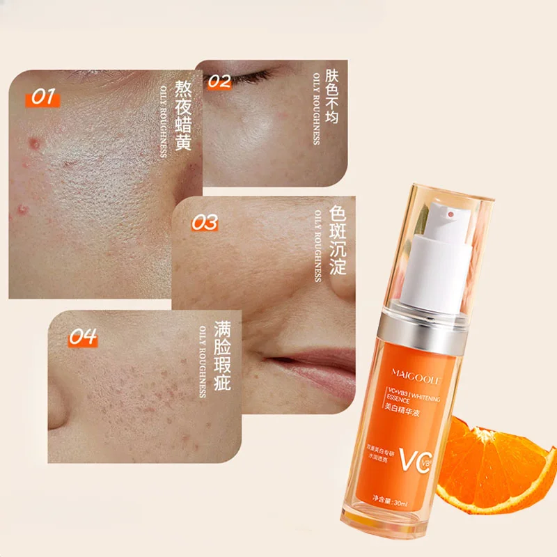 

Whitening Serum Brightens Skin Tone Whitening Freckle Removal Hydrating Moisturizing Oil Control Easy to Absorb Skincare