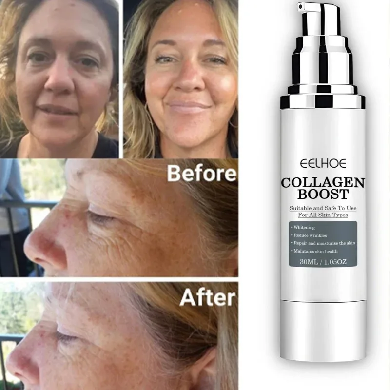 Women's Collagen Enhancement Cream Brightens Skin Tone Lightens Facial Lines Facial Rejuvenation Essence Cream Skin Care