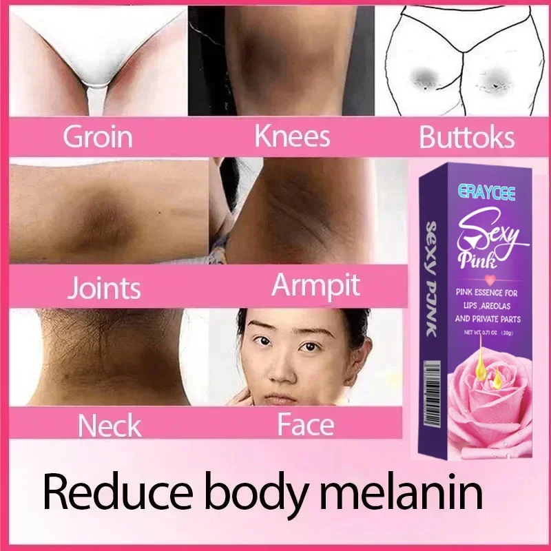 Whitening Cream Private Parts Underarm Bleaching Gel Whiten Lips Butt Knee Brighten Inner Thigh Intimate Parts Dark Remove Care