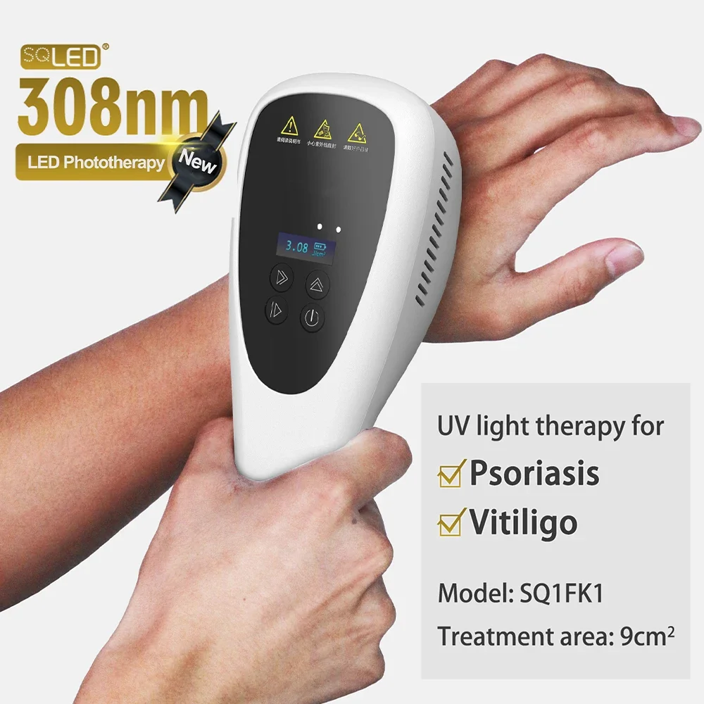 UVB luz portátil tratamento máquina, casa fototerapia, dermatite, micose, fungóides, pitiríase, rósea