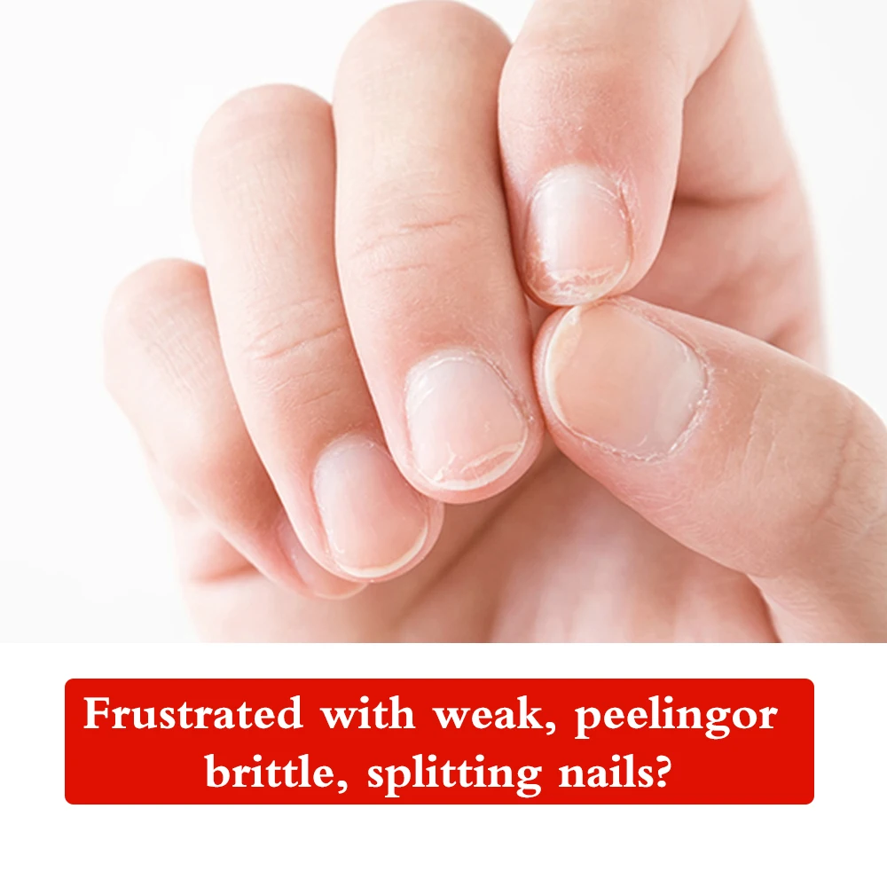 كوديس جل علاج تقوية الأظافر للأظافر الناعمة الرقيقة غير الكمال معطف قاعدة الكيراتين نظام نمو الأظافر زيت البروتين الطبيعي