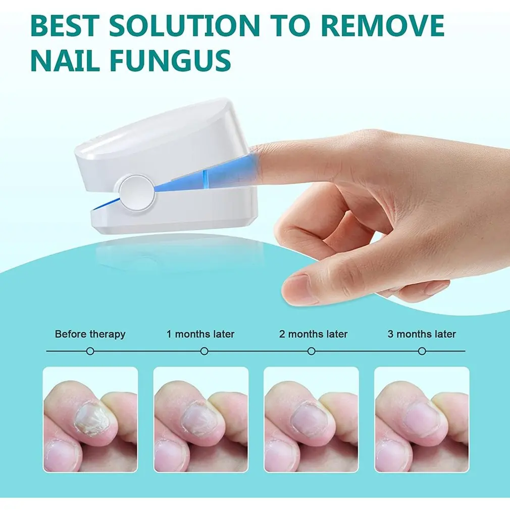 Rechargeable Nail Fungus Remover Toenail Fungus Cleaning Laser Device Portable Nail Assisted Phototherapy Cleaning Lamp