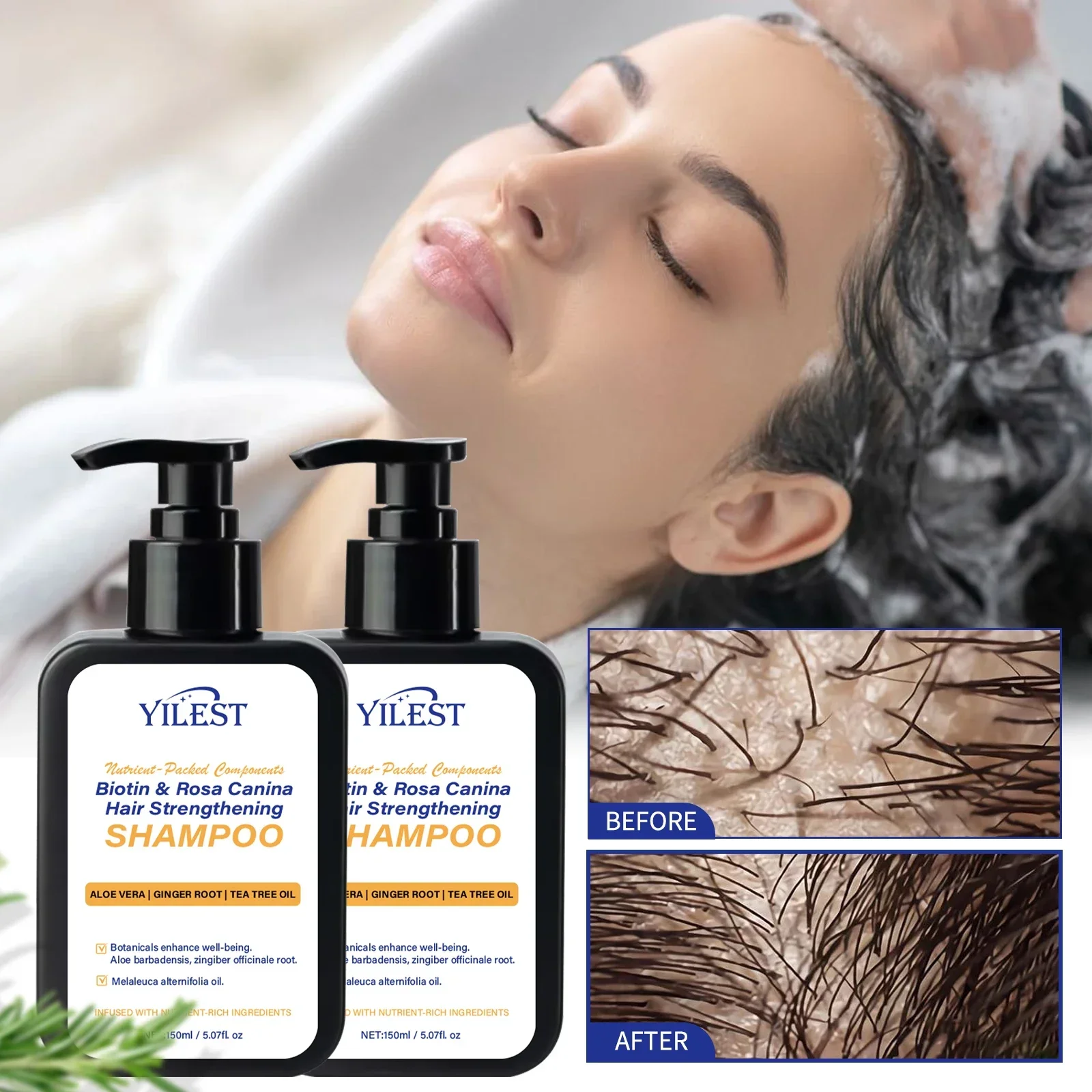 

Rosa Canina Biotin Shampoo Hair Growth Deep Cleansing Scalp Care Oil Control Reduce Breakage Strengthening Hair Root Shampoo