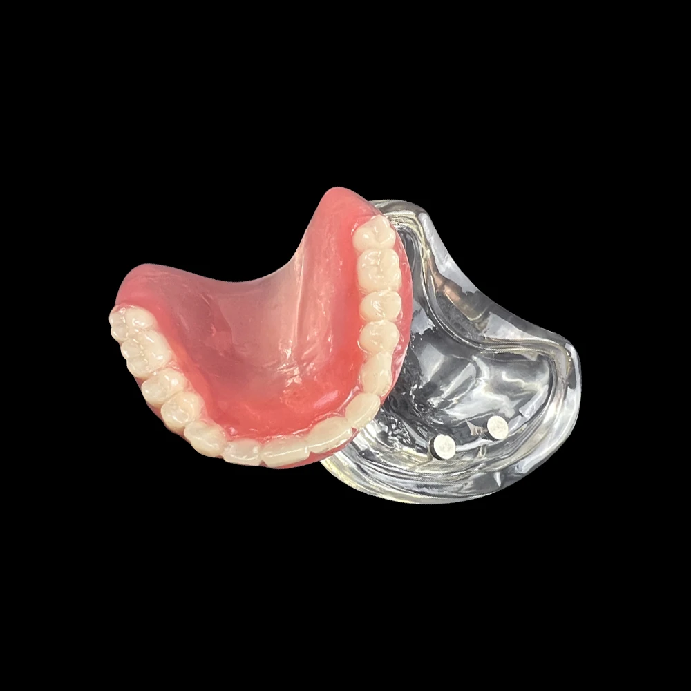 Dental Upper Overdenture Teeth Model Magnetic Adsorption Removable Superior Mandibular For Student Dentist Demo Study Teach