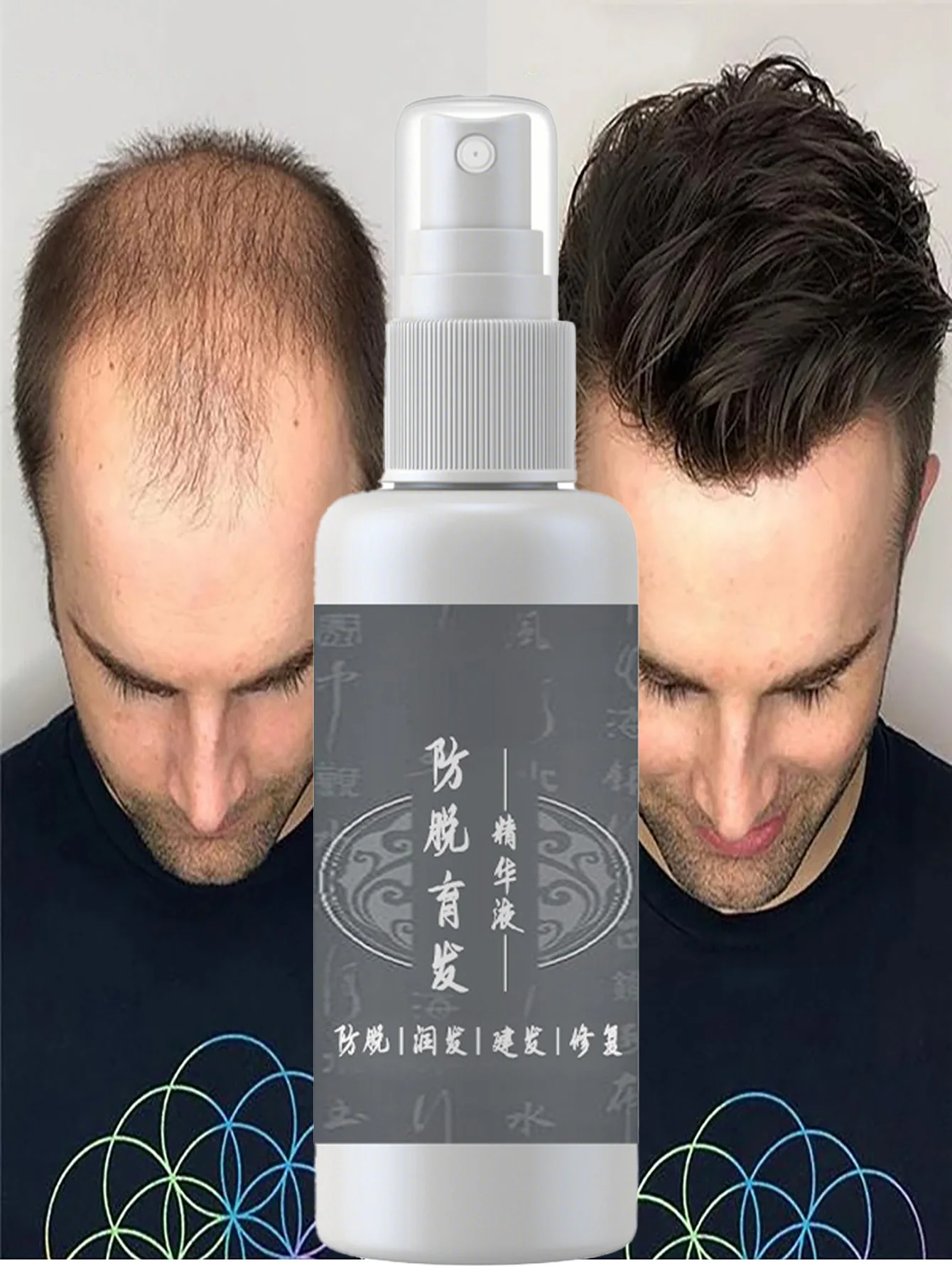 

Magic Hair Regrowth Spray Essence Serum Health Hair Grow Liquid Hair Loss Ginger Hair Tonic Oil for Men Women