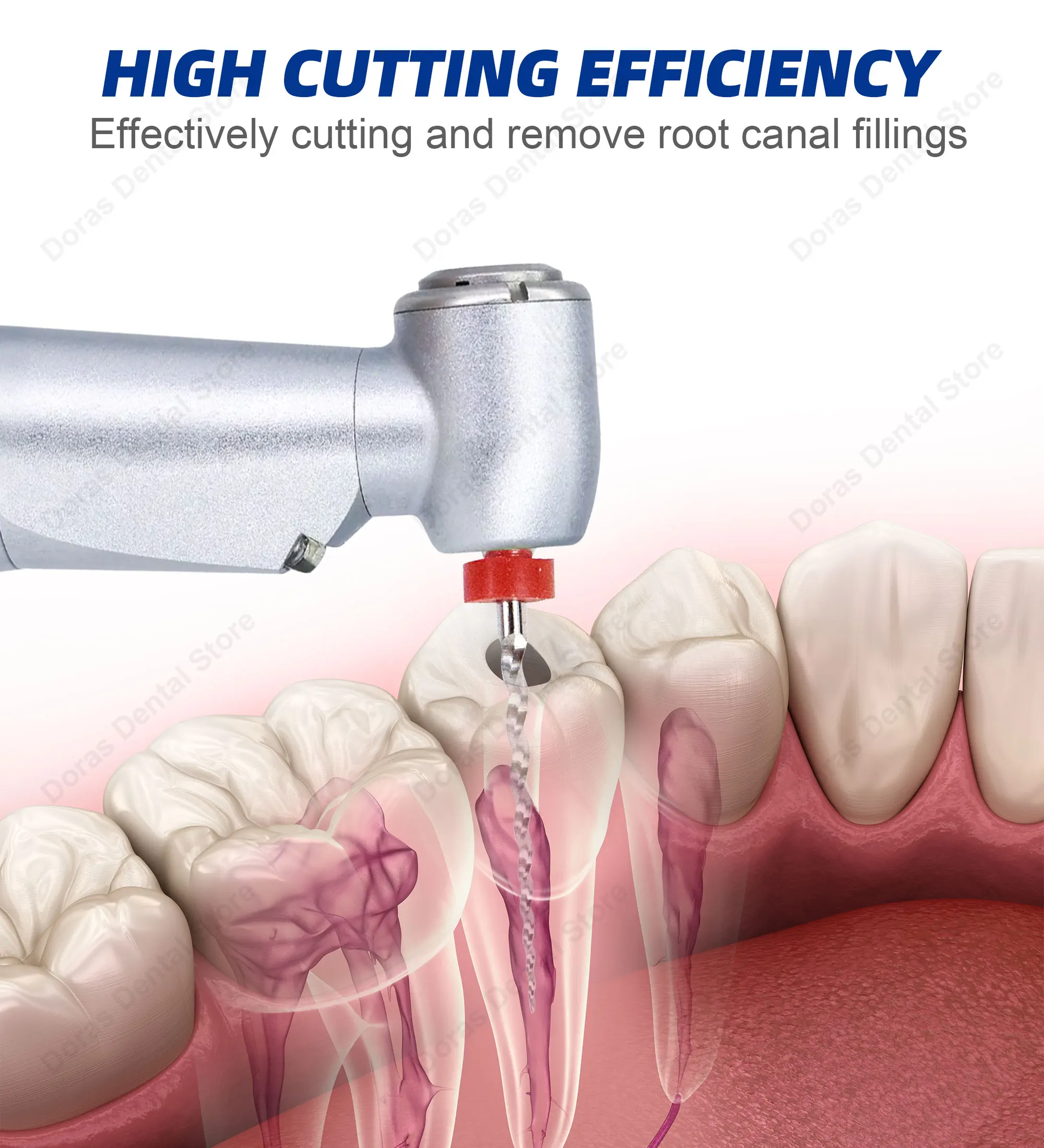Glin Dental Super D Retreatment Files For Root Canal Treatment Endodontic Files Rotary Files D1-D3 Dentistry Instrument