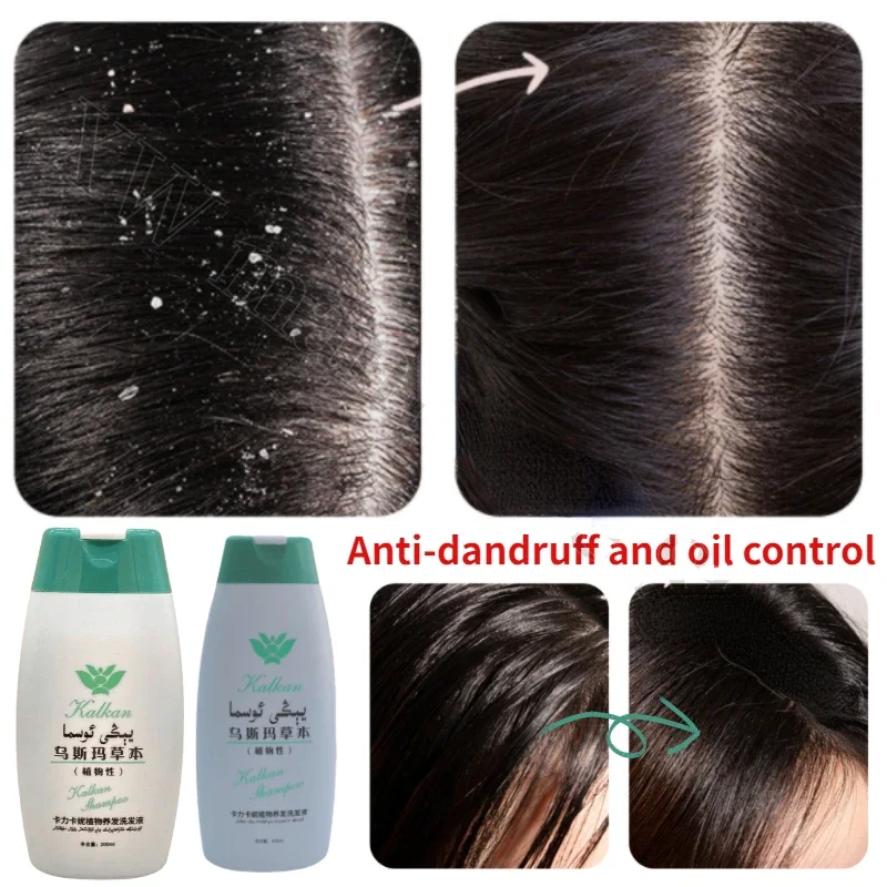 

Usman grass shampoo dandruff antipruritic promote scalp nutrition prevent hair loss repair hair improve hair loss