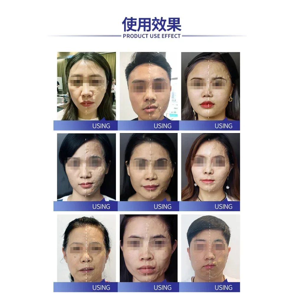 مجموعة قناع الوجه Pro-Xylane Witch مكونة من 6 أزواج من منتجات العناية بالبشرة المضادة للتجاعيد وشد البشرة وتشكيل الوجه ومضادة للشيخوخة