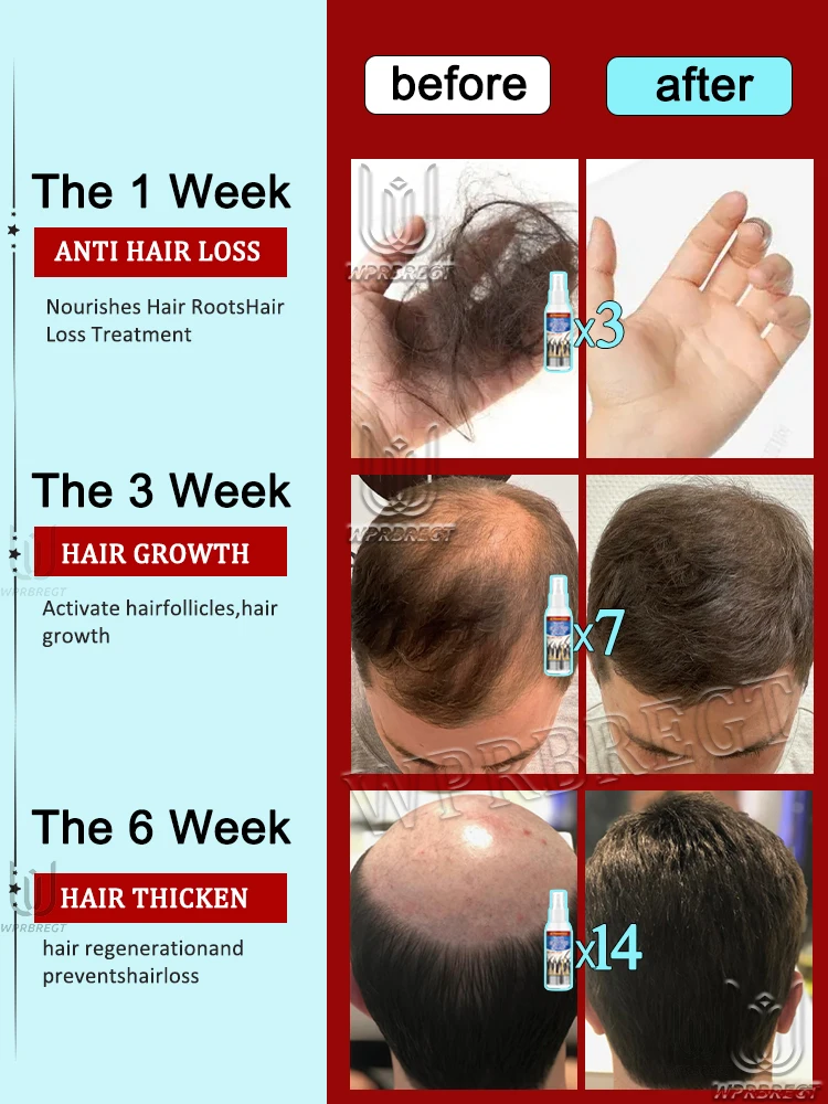 تركيبة مغذية جديدة للجذور لزيادة حجم الشعر 10 سم