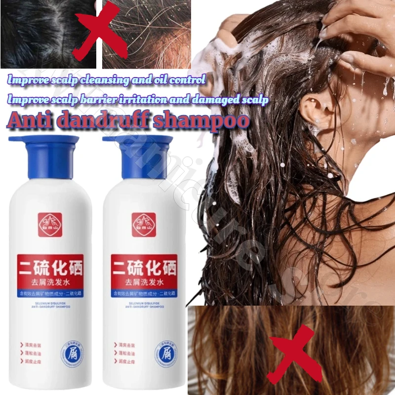 Anti-dandruff and Anti-itch Shampoo Plant Extracts Deep Cleansing Improving Scalp Barrier Oil Control Fluffy Exfoliating Shampoo