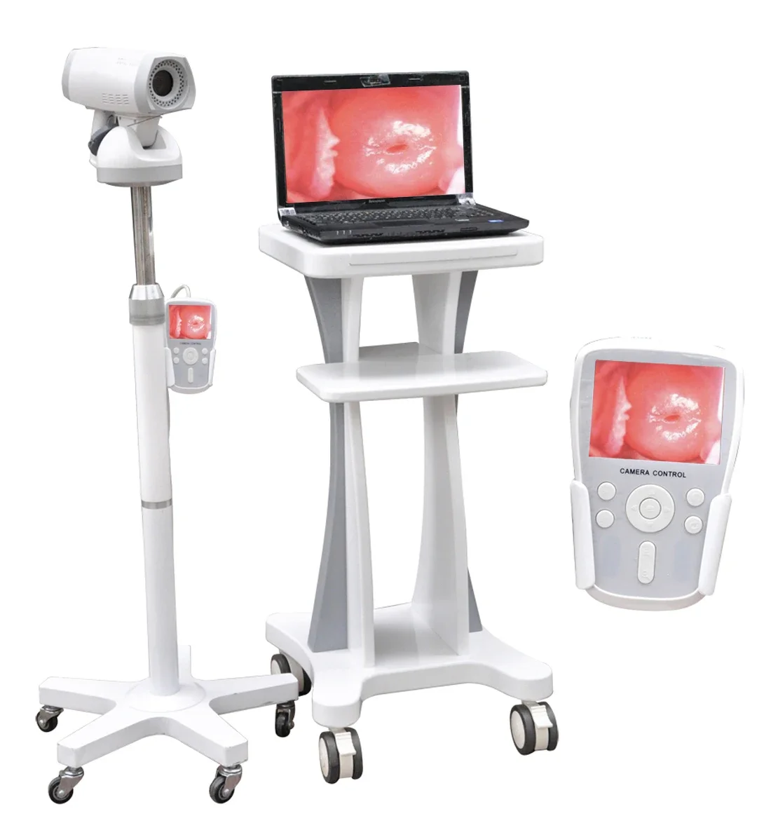 Clinic Hospital Medical Portable HD Vaginal Cam-era Gynecology Digital Video Colpo-scope