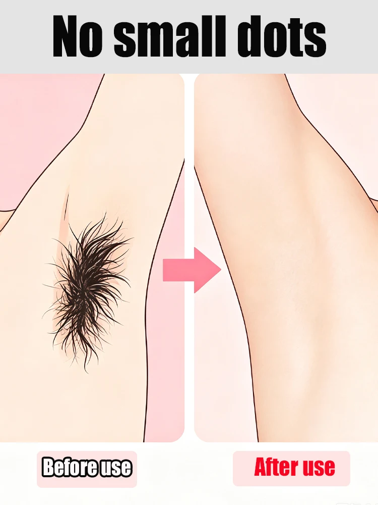 Smooth legs, feet, and underarms.