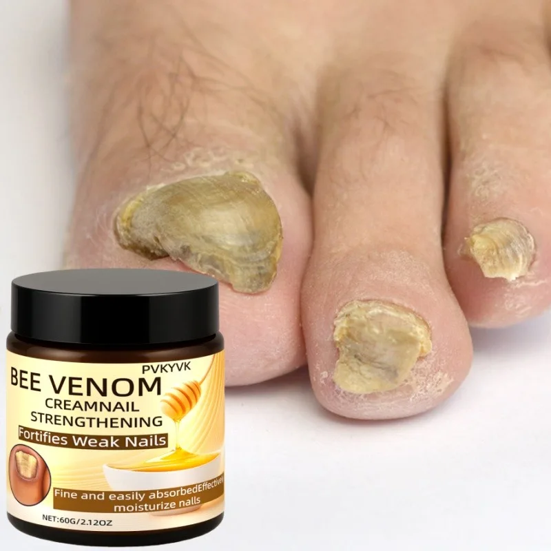 

Powerful nail cream, suitable for dry, rough, fragile nail care, containing urea smoothing,hardening,yellowing, quick absorption