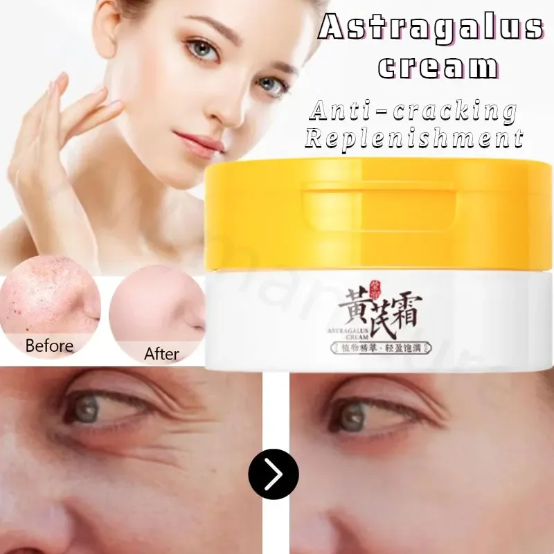 Replenishment Astragalus Cream 50g Hydrating Anti-freezing Anti-chapped Moisturizing Cream Deep Nourishing Moisturizing Cream