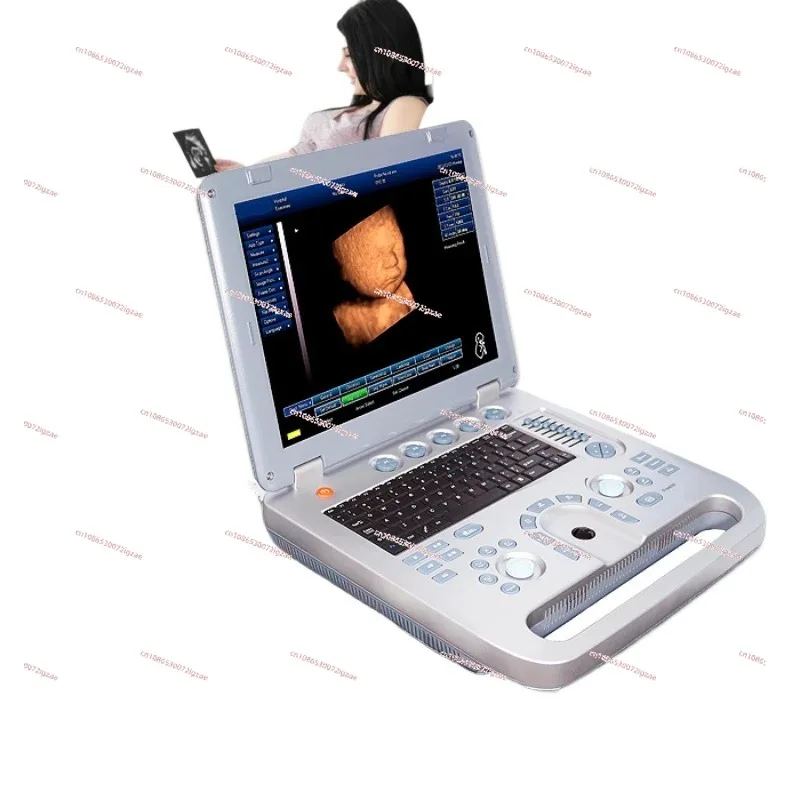 

High quality 3d ultrasound machine medical scan digital pseudo color usg 4d optional ecography