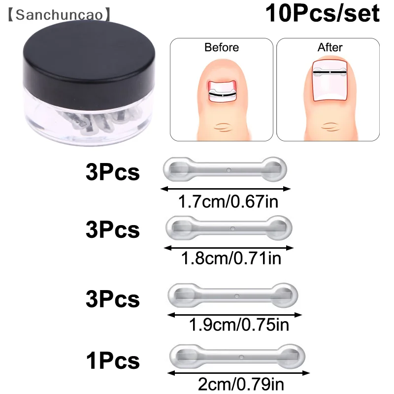 〔산〕10개입 내성발톱 치료 키트, 4가지 다양한 크기, 티타늄 합금 내성발톱 교정기, 곡선형 발톱 교정용