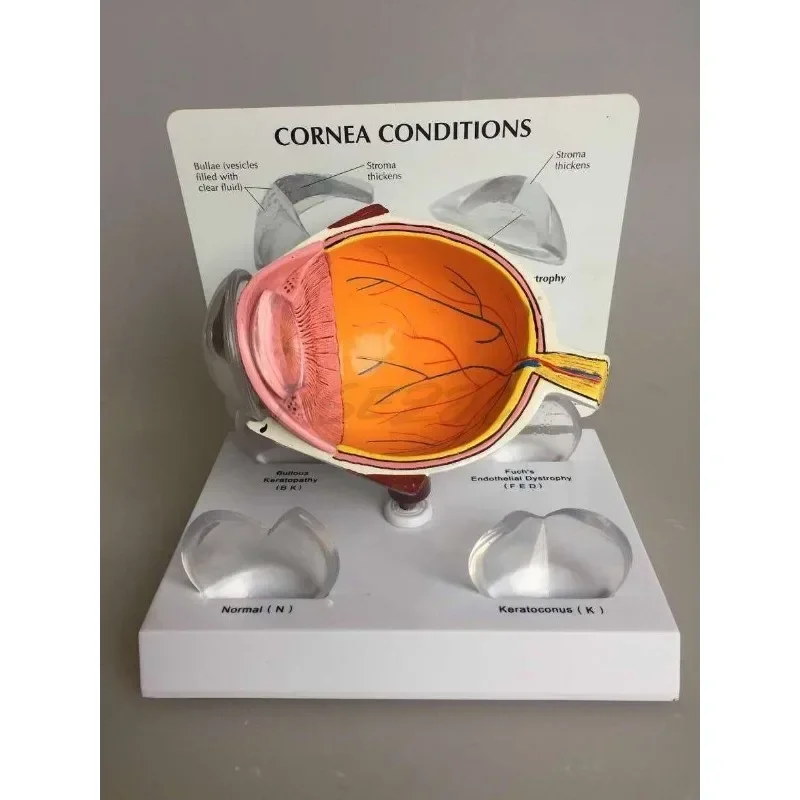 Modello per occhi Modello per malattie cororneali Specifica del libro di testo per l'insegnamento medico 12x10x8 cm
