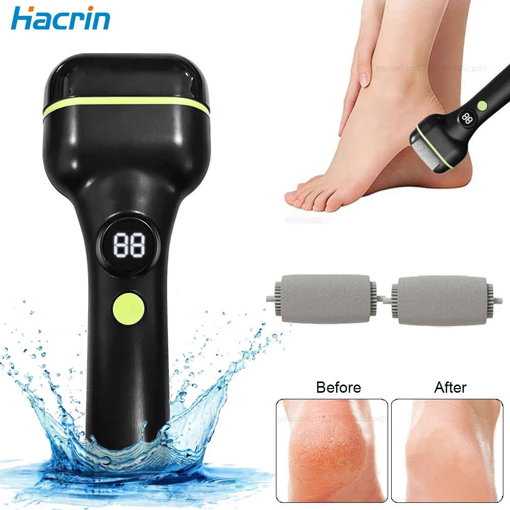 

Electric Foot Callus Remover Kit Rechargeable Callous Remover Portable Foot File Foot Scrubber File for Dead Skin Dry Skin