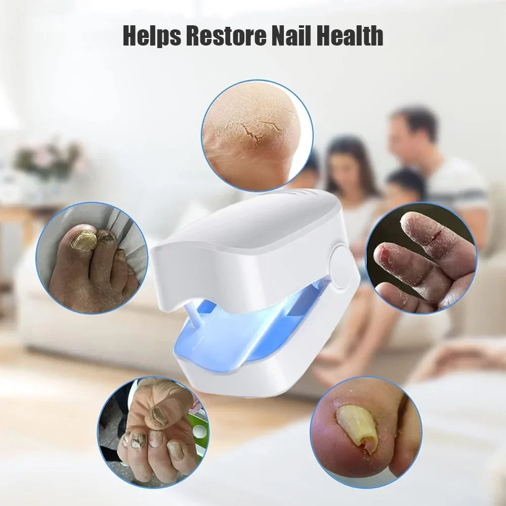 Nail Fungus Laser Treatment Device Repair Toenail Fingernail Fungus Treat Onychomycosis Therapy Cure Machine Effectively Remove