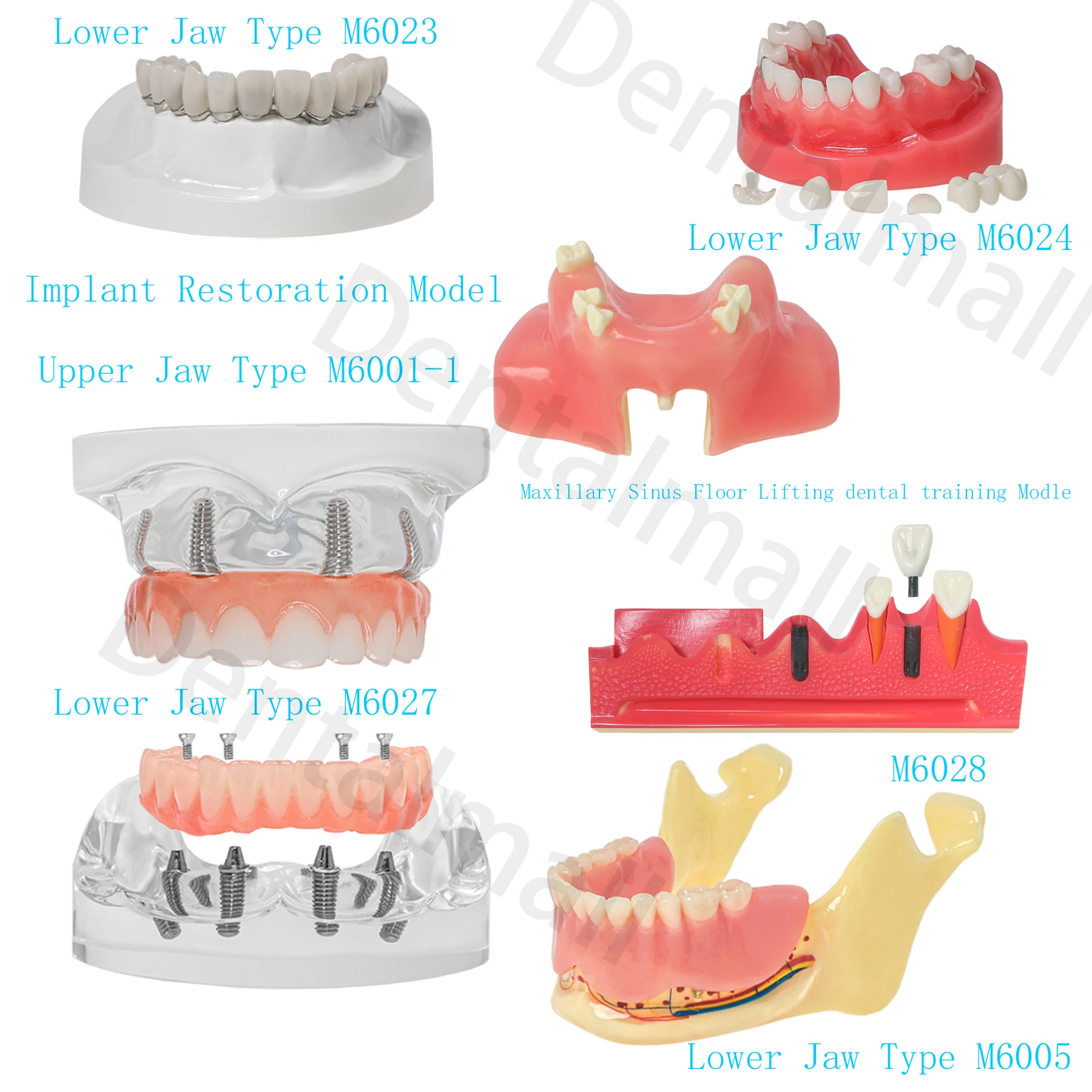 

Dental Teeth Model Typodont Implant Restoration Overdenture Demo Practice Type Model