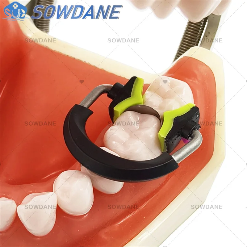 Dental NITI Clamping Ring Fit Palodent V3 System Nickel Titanium Sectional Matrice Band NITI PEEK Flexible Dentistry Tool - view 4