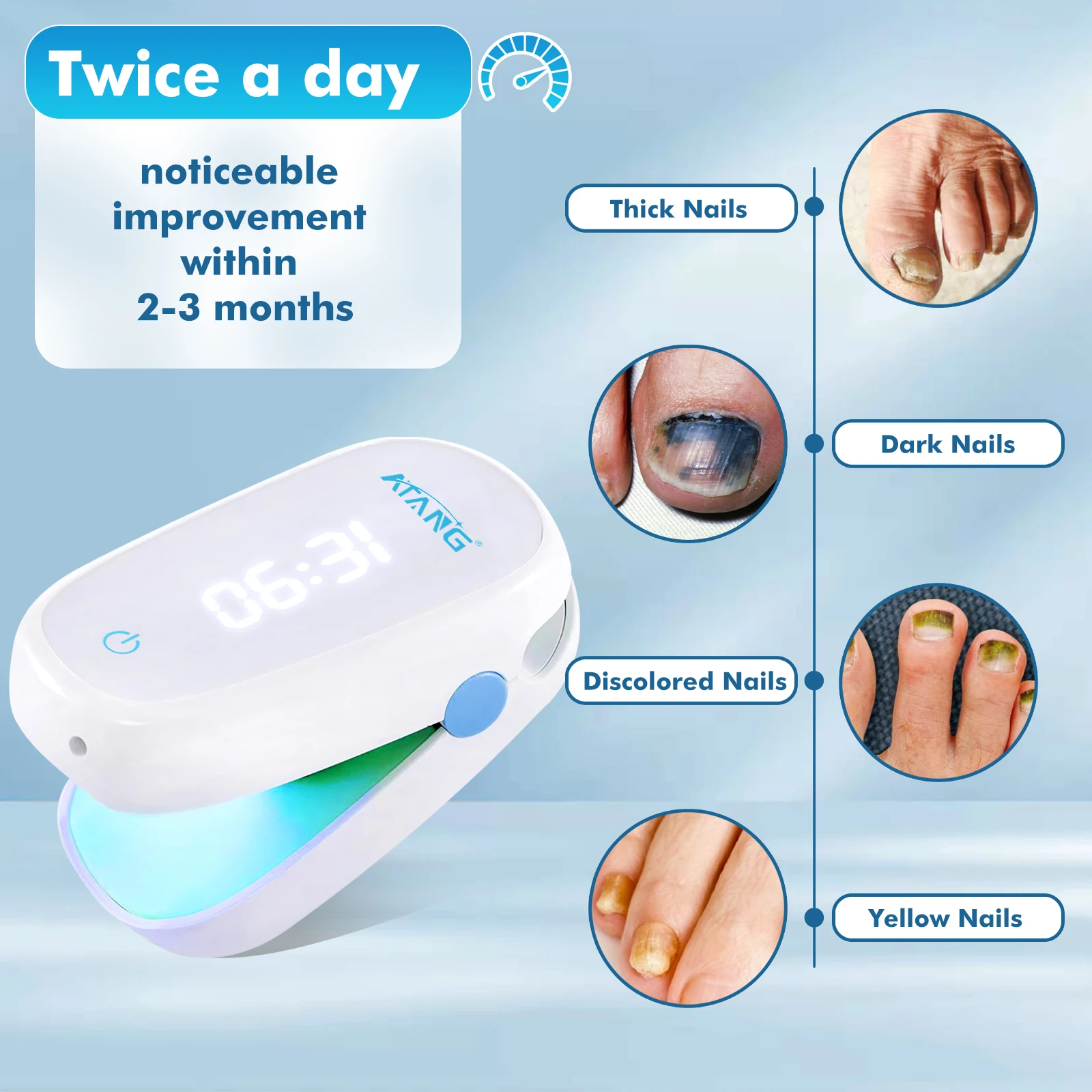 

Nail Fungus Laser Treatment Device Onychomycosis Repair Toenail Fingernail Fungus Nail Removal Anti Infection Cold Laser Therapy