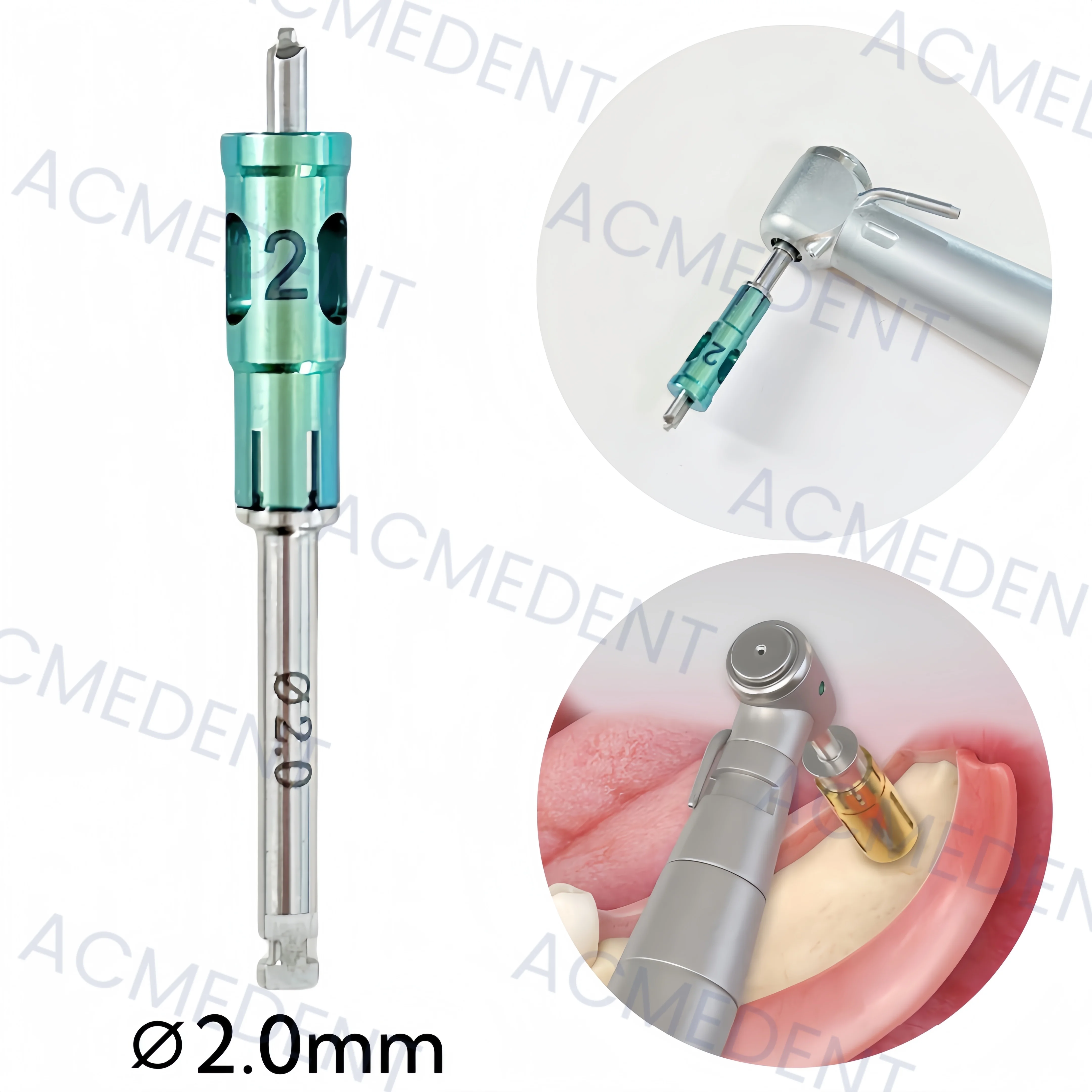 

∅2.0 Dental Bone Collector Drills NLBC Never Loss Stopper Self Bone Power Gain Autobone Chip Maker 1-10 шт.