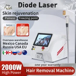 Diode Laser Hair Removal Machine 3 Wavelength 755 808nm 1064 Permanent Painless 2000W 1600W