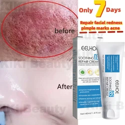 Instant Facial Redness Repair Cream Soothing Red Blood Rosacea Treatment Improve Sensitive Skin Moisturizing Skin Care Products