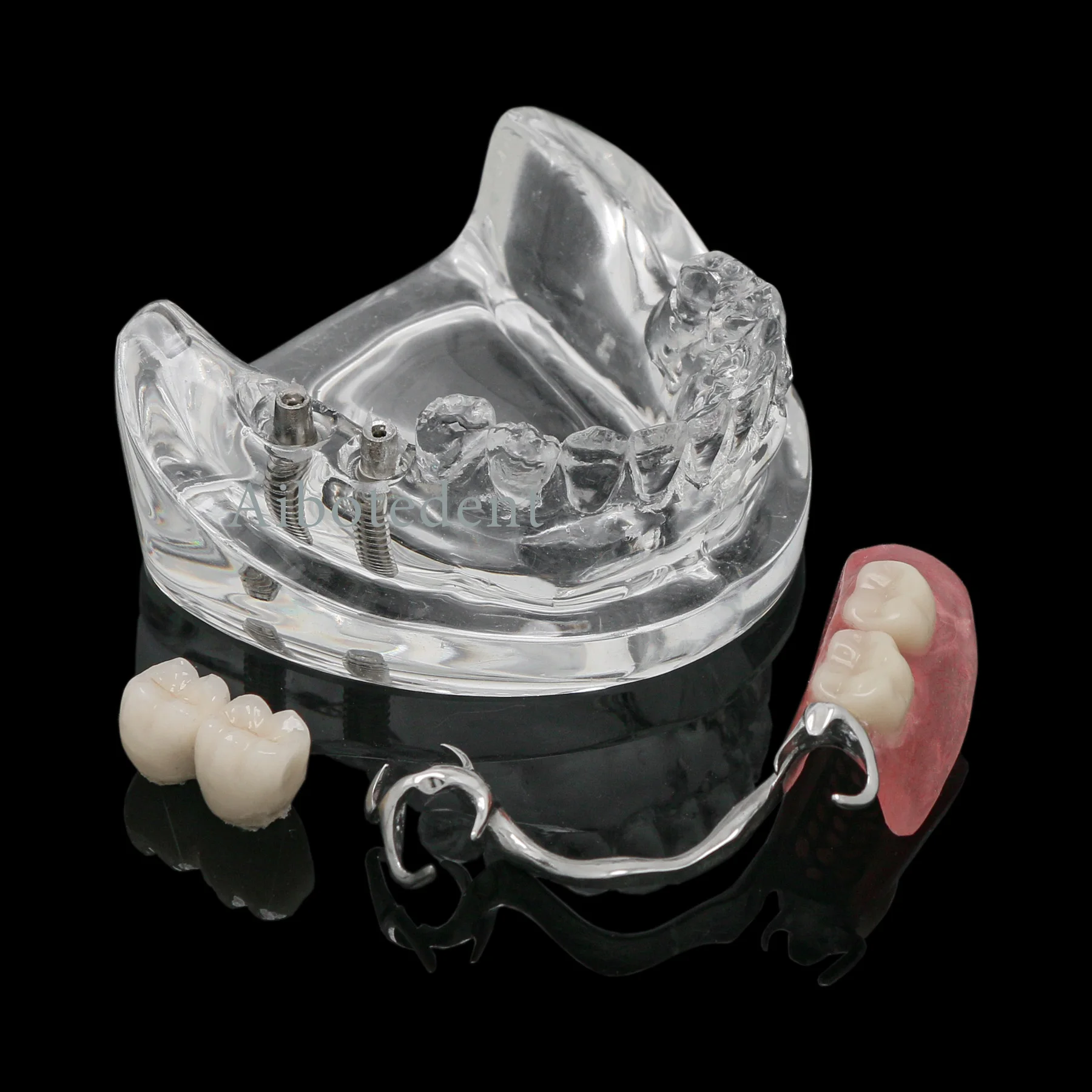 Dental M6022 Implant Dental Typodont Restoration Model with Partial Dentures Hands-on Training