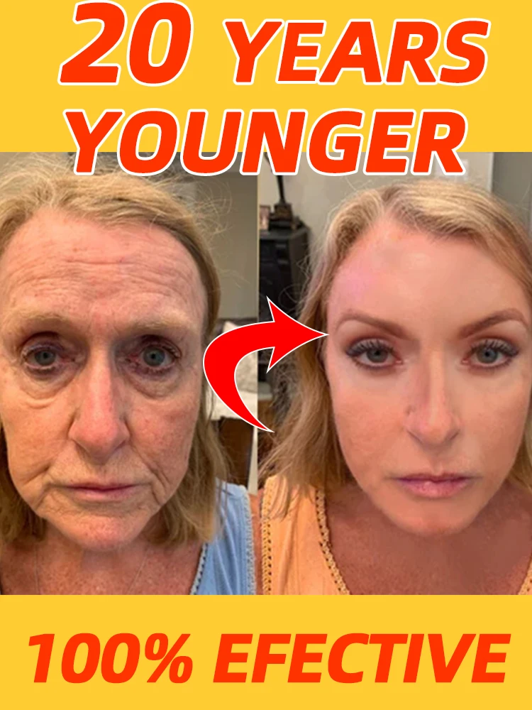 

20 years younger, 100% wrinkles disappear