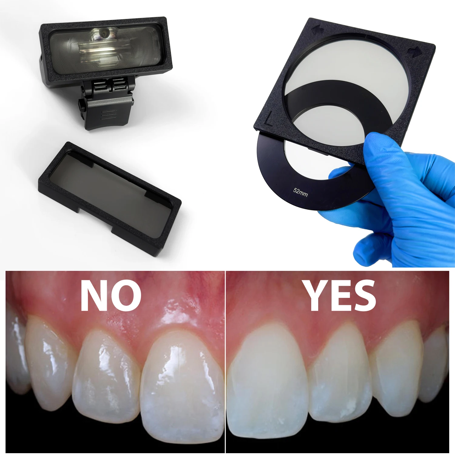 Kit de polarização cruzada dentária para flash de câmera godox mf12-sem refleções, kit de foto de polarização de câmera sem brilho para dentista