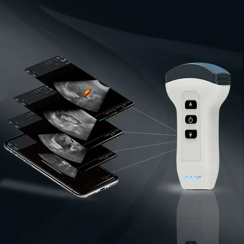 DW-C1 Wireless Probe Convex Wifi Convex Probe For Fetus Scan Abdomen Probe