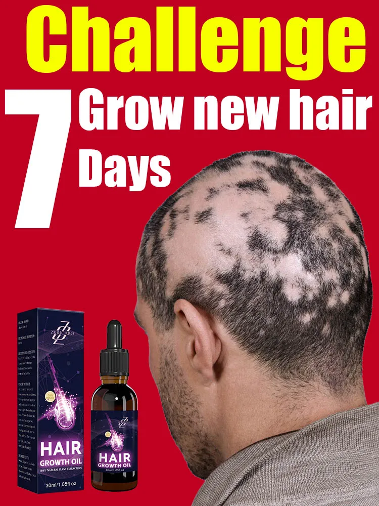 

Say goodbye to baldness and have thicker hair