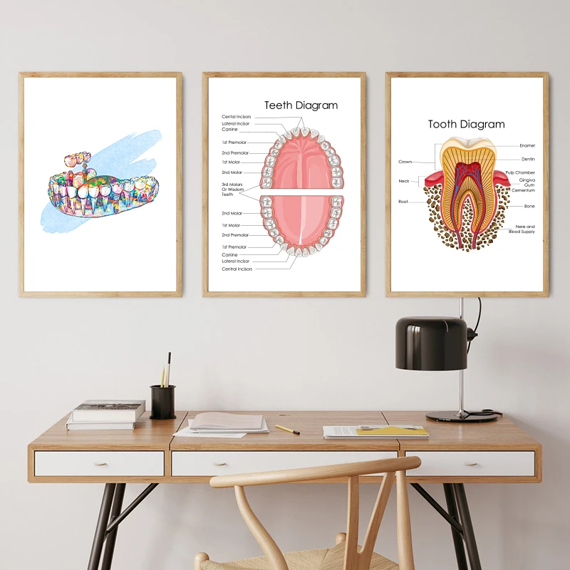 Tooth Implant Art Dental Crown Print Dentist Gift Tooth Anatomy Medical Wall Art Canvas Painting Picture Dental Clinic Decor