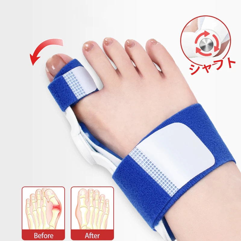 Bunion Splint Big Toe Straightener Corrector เท้า Relief Hallux Valgus Correction อุปกรณ์ศัลยกรรมกระดูก Pedicure Foot Care