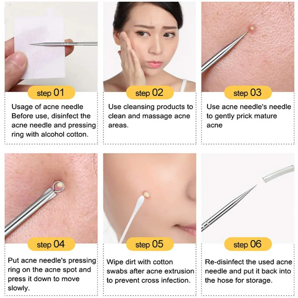 4pcs Stainless Steel Acne Removal Needles Pimple Blackhead Remover Tools Spoon Face Skin Care Tools Needles Facial Pore Cleaner