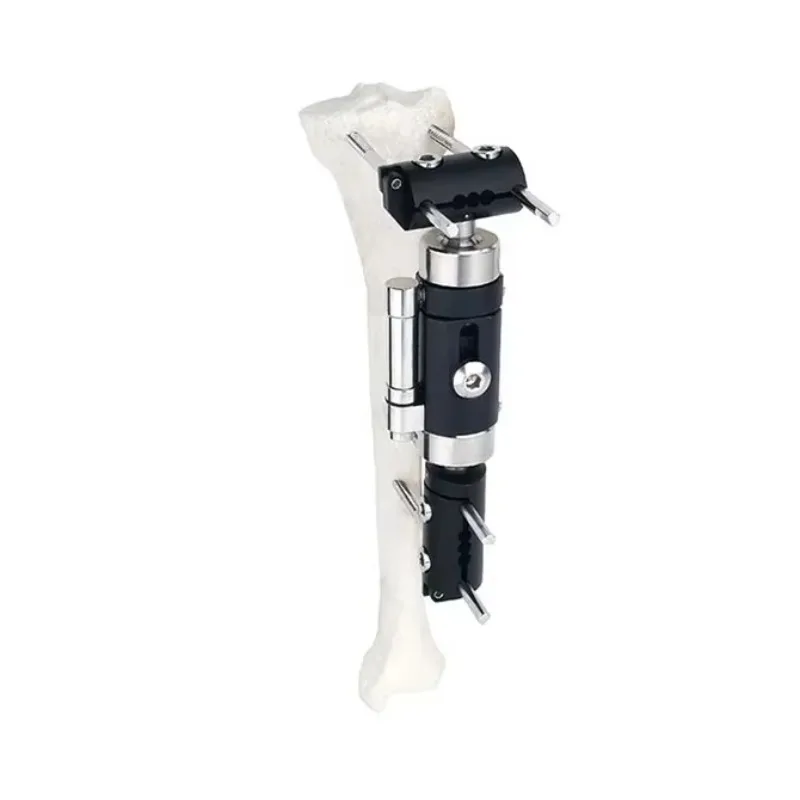2025High Quality External Fixation Wrist Dynamic Axial Fixator T type External Fixators