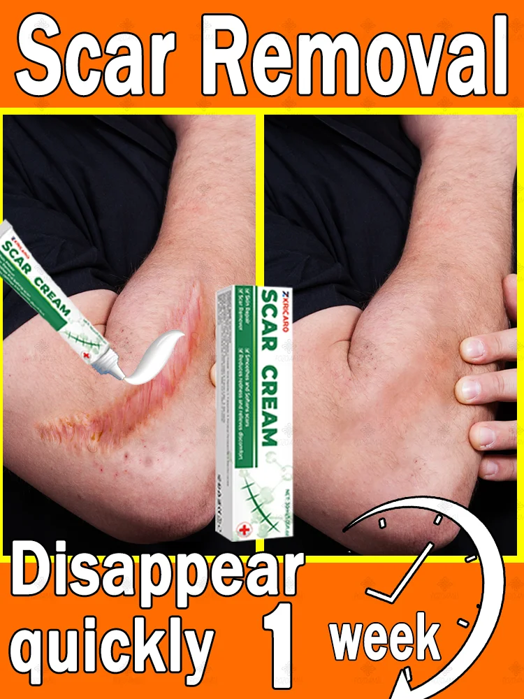 ᔆᶜᵃʳ ᴿᵉᵐᵒᵛⁱⁿᵍ ᶜʳᵉᵃᵐ