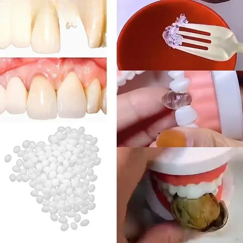 Resina 10g/15g/20g Denti E Lacune FalseTeeth Colla Solido Kit di Riparazione Temporanea Dei Denti Protesi Adesivo Sbiancamento Dei Denti bellezza dei denti