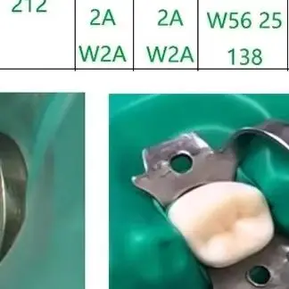 

5pcs/set Dental Rubber Dam Clamps Stainless Steel Endodontic Restorative Barrier Clips Oral Dentistry Materialstools