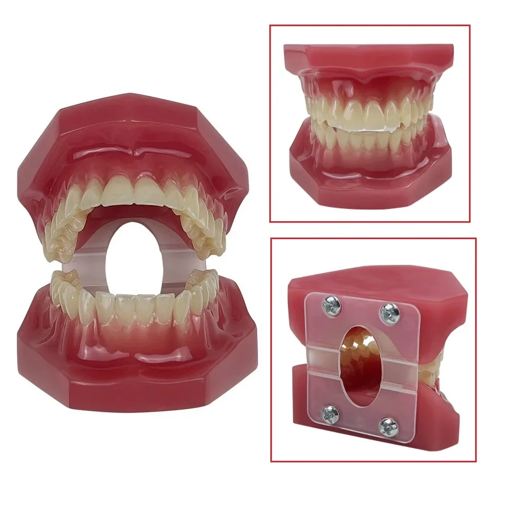 Dental Orthodontic Teeth Model Metal Ceramic Brackets Ligature Ties Ortho Treatment Typodont Dentistry Education Demonstration