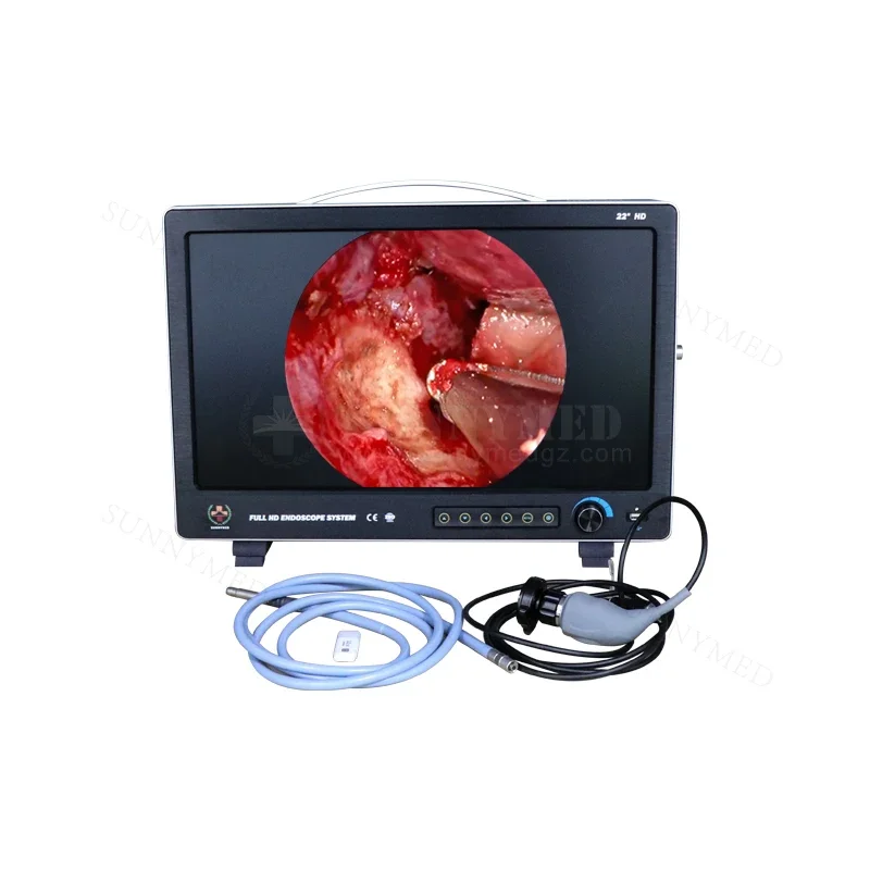 1080p full hd  endoscope system ent endoscopy hd  endoscope  arthroscope ent endoscope