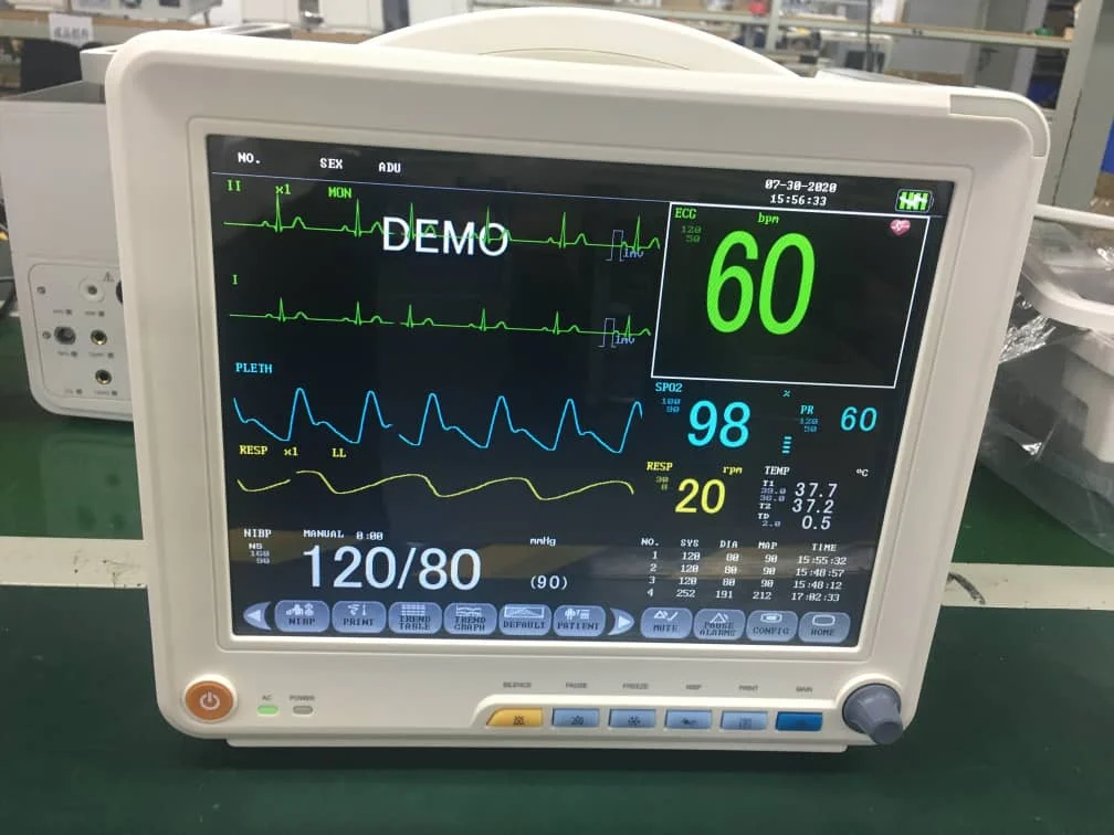 High Quality 12 inch multi-parameters Ambulance Vital Cardiac Monitor for hospital use