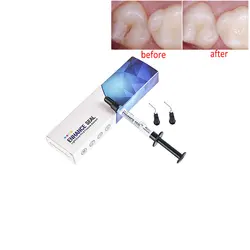 Dental Light Cure Pit e Fissura Selante, Formação de cárie em cavidades e sulcos dos dentes