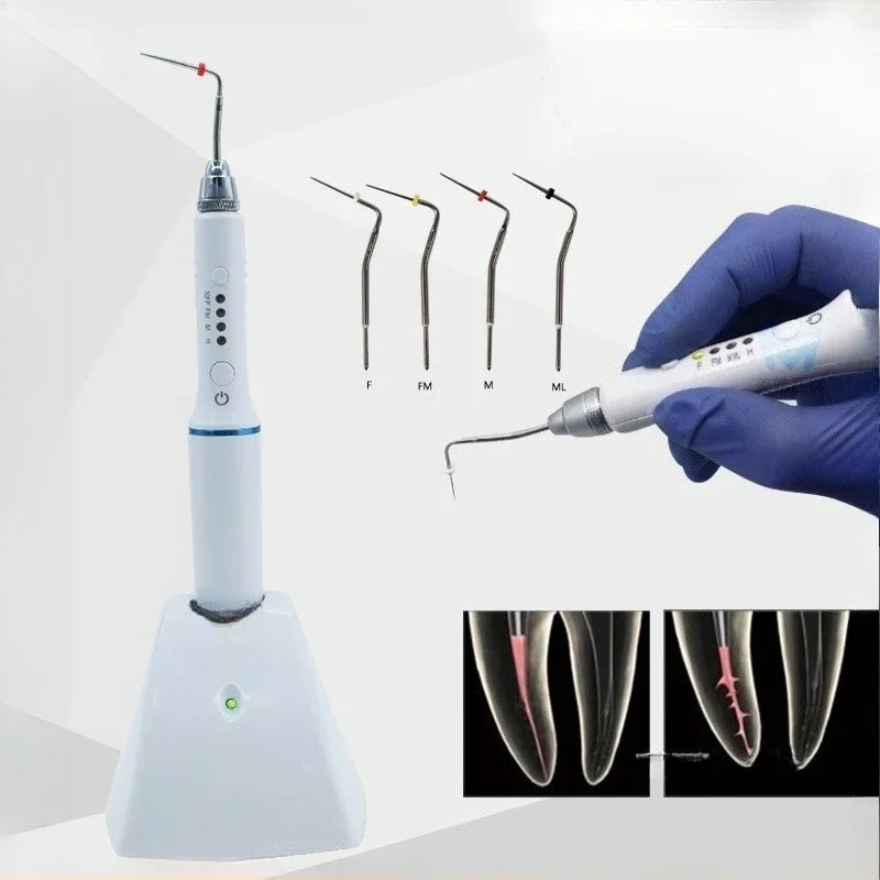 Glue tip hot melt pen root canal filling glue tip cutter