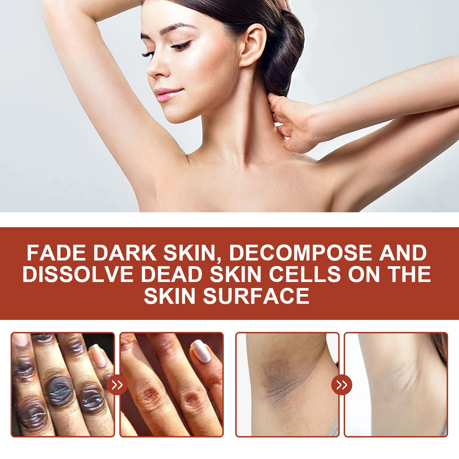 زيت تقشير EELHOE لتبييض البشرة الداكنة وإزالة مقشر الجلد الميت والذراع والكوع والركبة والساق زيت تقشير Nigricans 110 مللي