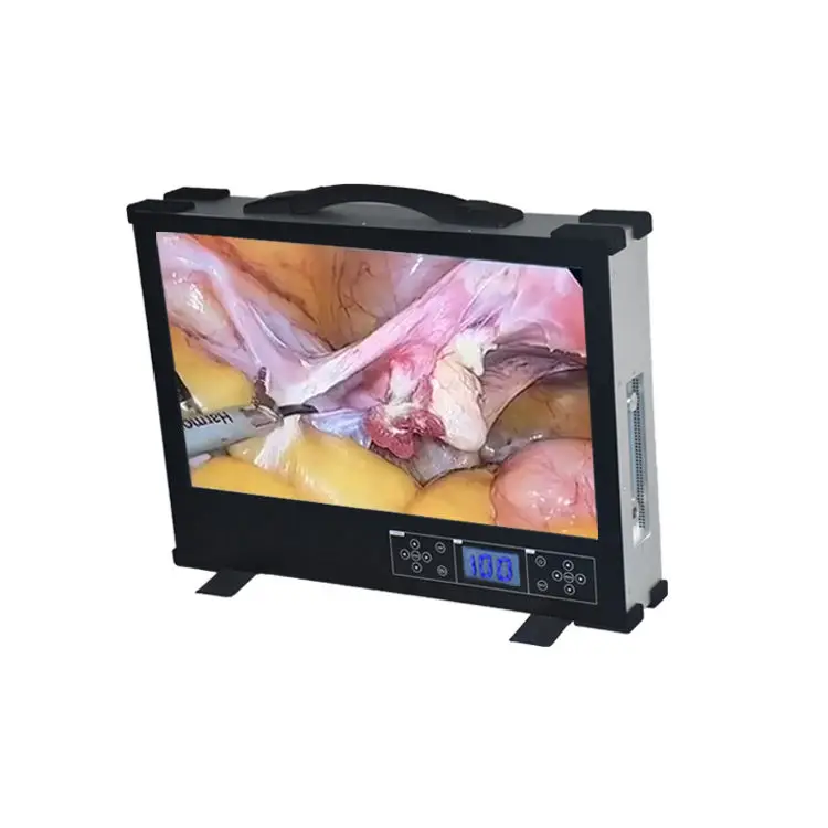 High Resolution 24 Inch hd Lcd Screen Medical Endoscope Camera  Flexible Endoscopy Camera Rigid Endoscope Ent Full